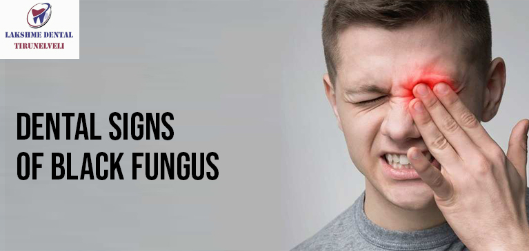 Dental Signs of Black fungus