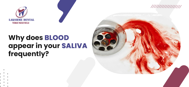 Why does blood appear in your saliva frequently ?