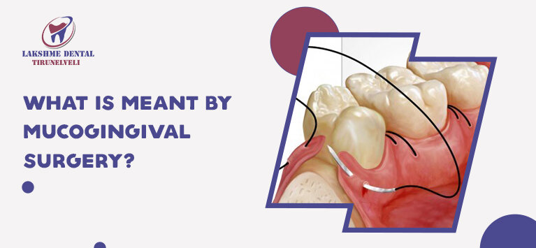 What is meant by Mucogingival Surgery?