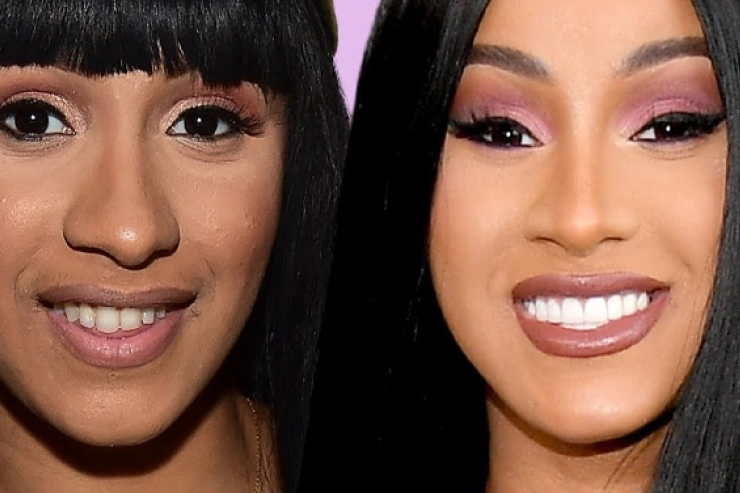 Cardi B- Celebrities Teeth Before After