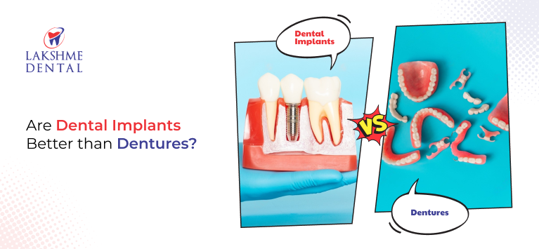 Are Dental Implants Better than Dentures?