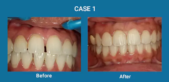 Before & After