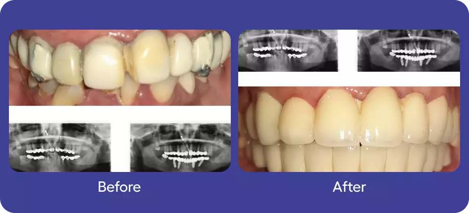 Before & After