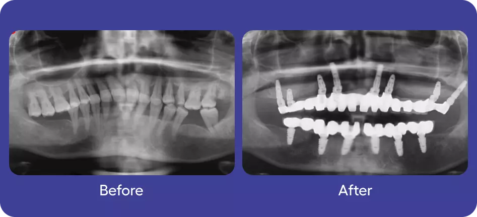 Before & After