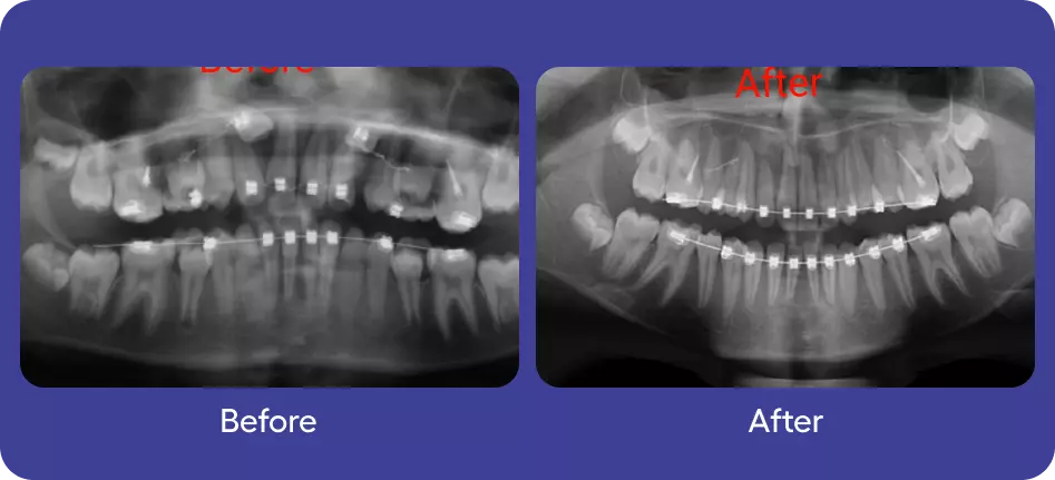 Before & After