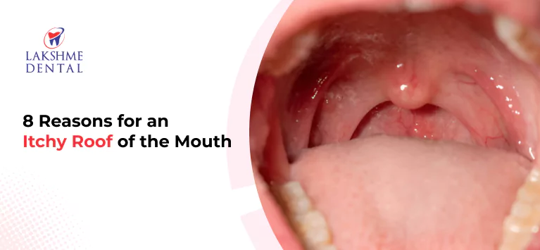 8 Reasons for an Itchy Roof of the Mouth