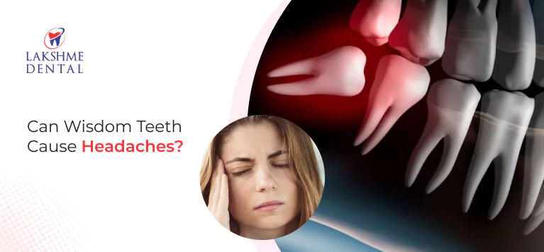 Can Wisdom Teeth Cause Headaches?