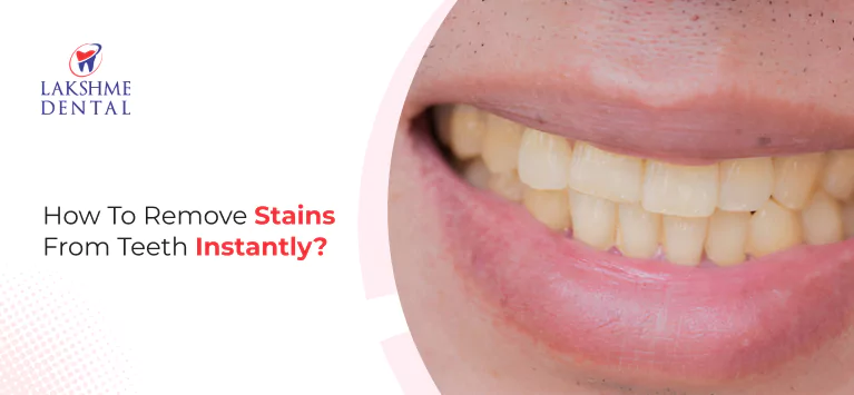 How To Remove Stains From Teeth Instantly?