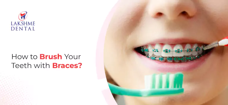 How to Brush Your Teeth with Braces?